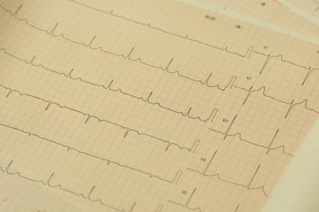心電図異常・雑音について